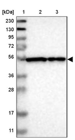 FKBP9 Antibody in Western Blot (WB)