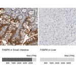 FABP6 Antibody in Immunohistochemistry (IHC)