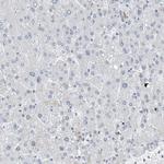 FABP6 Antibody in Immunohistochemistry (IHC)