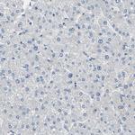 ALDH18A1 Antibody in Immunohistochemistry (IHC)