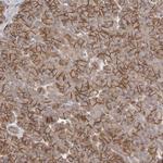 NRCAM Polyclonal Antibody