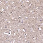 CADM4 Antibody in Immunohistochemistry (Paraffin) (IHC (P))