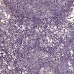 CADM4 Antibody in Immunohistochemistry (Paraffin) (IHC (P))