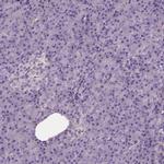 CADM4 Antibody in Immunohistochemistry (IHC)