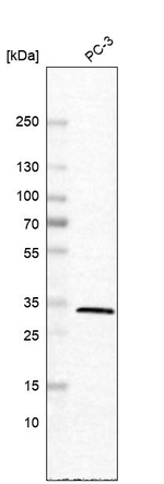 Carbonic Anhydrase VB Antibody in Western Blot (WB)