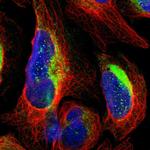 RHOT2 Antibody in Immunocytochemistry (ICC/IF)