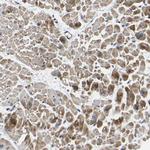 RHOT2 Antibody in Immunohistochemistry (Paraffin) (IHC (P))