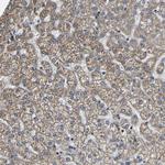 RHOT2 Antibody in Immunohistochemistry (Paraffin) (IHC (P))