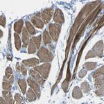RHOT2 Antibody in Immunohistochemistry (Paraffin) (IHC (P))