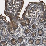 RHOT2 Antibody in Immunohistochemistry (Paraffin) (IHC (P))