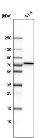 GALNT1 Polyclonal Antibody