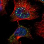 CLMN Polyclonal Antibody