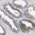 CLMN Antibody in Immunohistochemistry (Paraffin) (IHC (P))