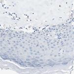 CLMN Antibody in Immunohistochemistry (Paraffin) (IHC (P))