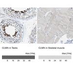 CLMN Antibody in Immunohistochemistry (IHC)