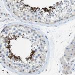 CLMN Antibody in Immunohistochemistry (IHC)