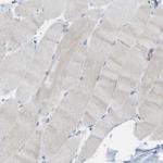 CLMN Antibody in Immunohistochemistry (IHC)