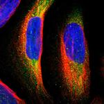 MTH1 Polyclonal Antibody