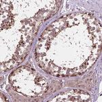 MTH1 Antibody in Immunohistochemistry (Paraffin) (IHC (P))