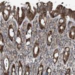 GALNT8 Antibody in Immunohistochemistry (IHC)