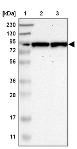 GALNT8 Antibody in Western Blot (WB)