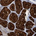 MPPE1 Antibody in Immunohistochemistry (Paraffin) (IHC (P))