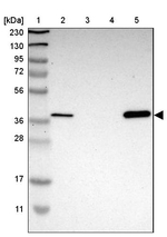 MPPE1 Antibody in Western Blot (WB)