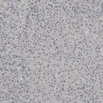 PLA2R1 Antibody in Immunohistochemistry (IHC)