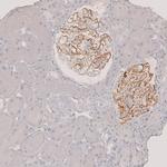 PLA2R1 Polyclonal Antibody