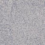 PLA2R1 Antibody in Immunohistochemistry (IHC)