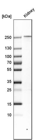 PLA2R1 Antibody in Western Blot (WB)