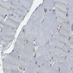 SPTBN1 Antibody in Immunohistochemistry (Paraffin) (IHC (P))