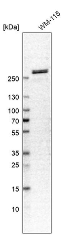 SPTBN1 Antibody in Western Blot (WB)
