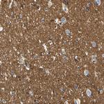 SPTBN1 Antibody in Immunohistochemistry (IHC)