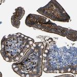 PTPRF Antibody in Immunohistochemistry (Paraffin) (IHC (P))