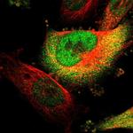 PIGL Polyclonal Antibody