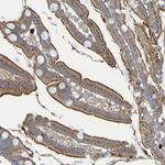 C11orf24 Polyclonal Antibody