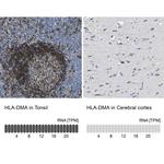 HLA-DMA Polyclonal Antibody