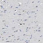 HLA-DMA Antibody in Immunohistochemistry (IHC)