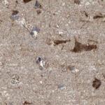 UGGT1 Antibody in Immunohistochemistry (IHC)