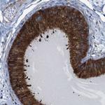 UGGT1 Polyclonal Antibody