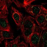 DPEP1 Polyclonal Antibody