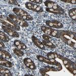 FKTN Polyclonal Antibody