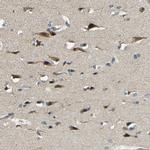 FNDC3A Antibody in Immunohistochemistry (Paraffin) (IHC (P))