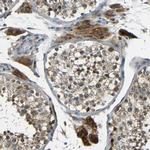 FNDC3A Polyclonal Antibody