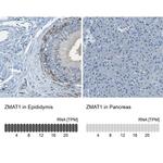 ZMAT1 Polyclonal Antibody