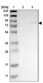 ZMAT1 Antibody in Western Blot (WB)