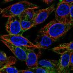 ASGR1 Polyclonal Antibody