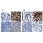 ASGR1 Antibody in Immunohistochemistry (IHC)