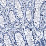 ASGR1 Antibody in Immunohistochemistry (IHC)
